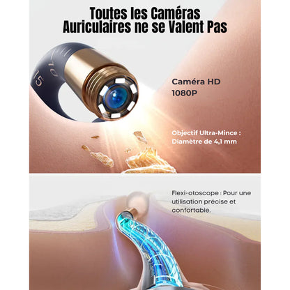 Limpiador de Oídos Bebird EarSight Plus