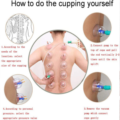 Tasses de thérapie cupping en silicone lot de 12