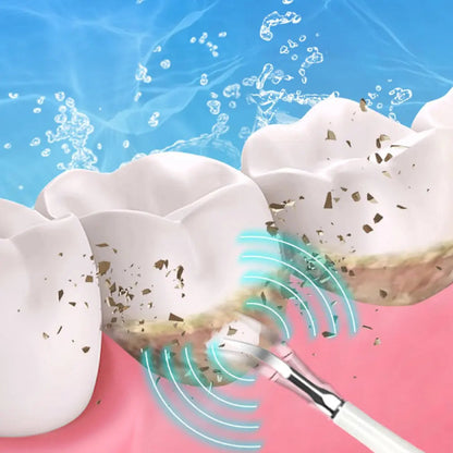 SparkSonic™ – Limpiador dental sónico con irrigación integrada
