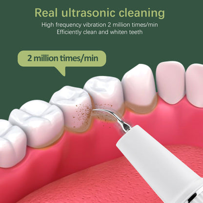 UltraSpark™ – Détartreur Dentaire Ultrason, l’Appareil Dentaire pour un Sourire Éclatant